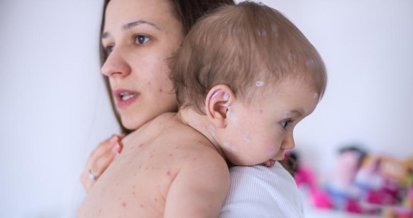 Woman with measles may have exposed entire 'Avengers: Endgame' audience to virus