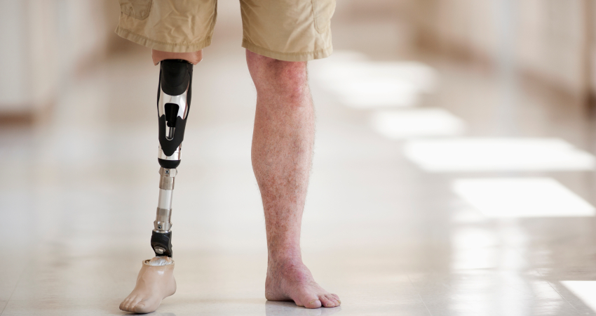 Amputee forced to crawl on anniversary vacation after airline confiscates scooter batteries