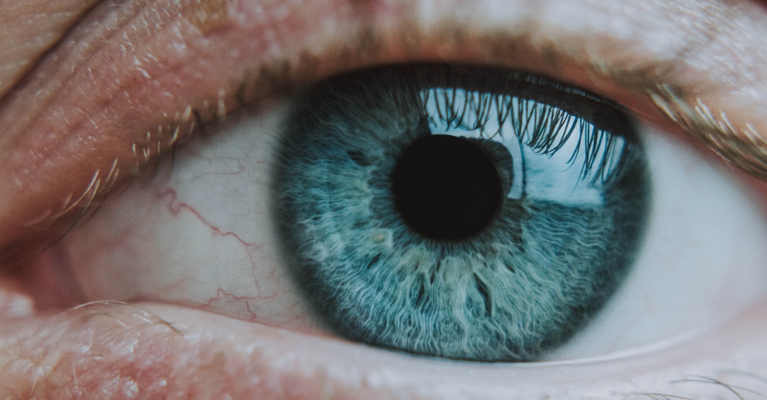 Mom urged to seek a doctor after sharing photo of daughter's eye