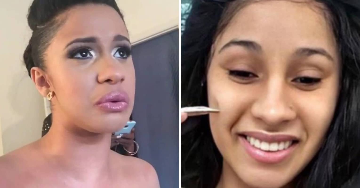 Cardi B Shares Photo Of Acne As She Asks Her Fans For Help