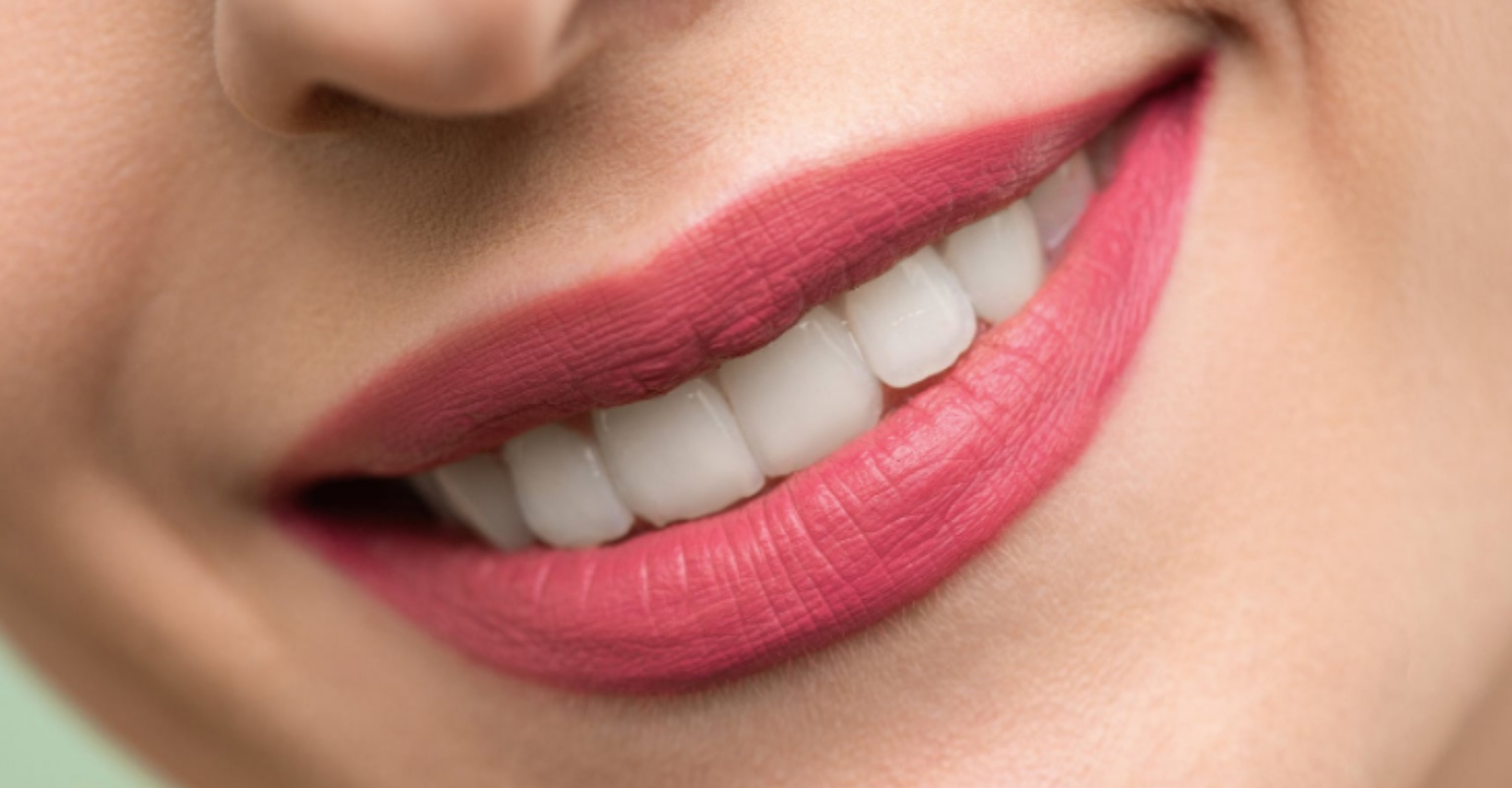 Model with 'world's biggest cheeks' shows off real teeth without veneers