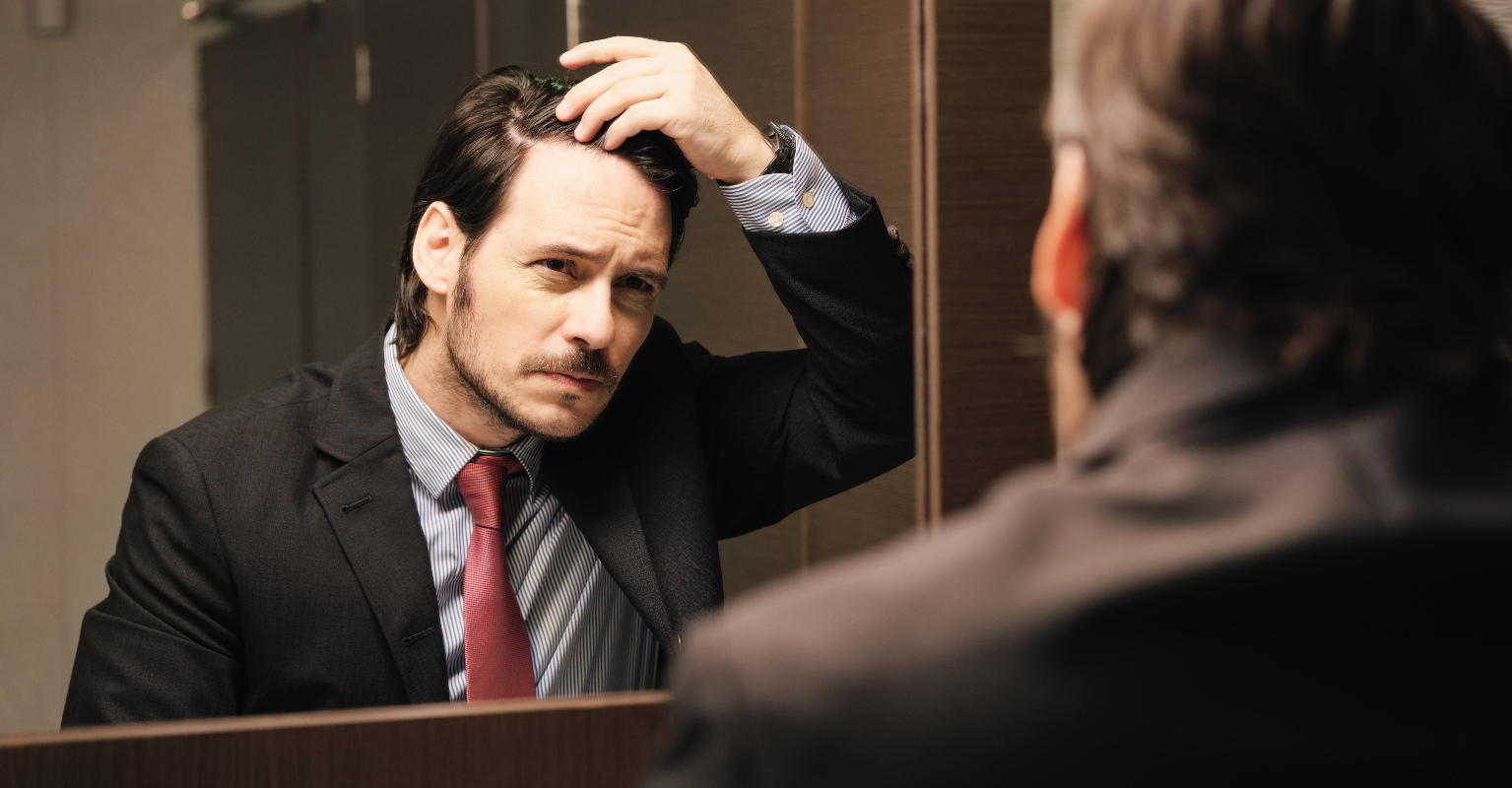 Man praised for candidly showing how he covers his receding hairline