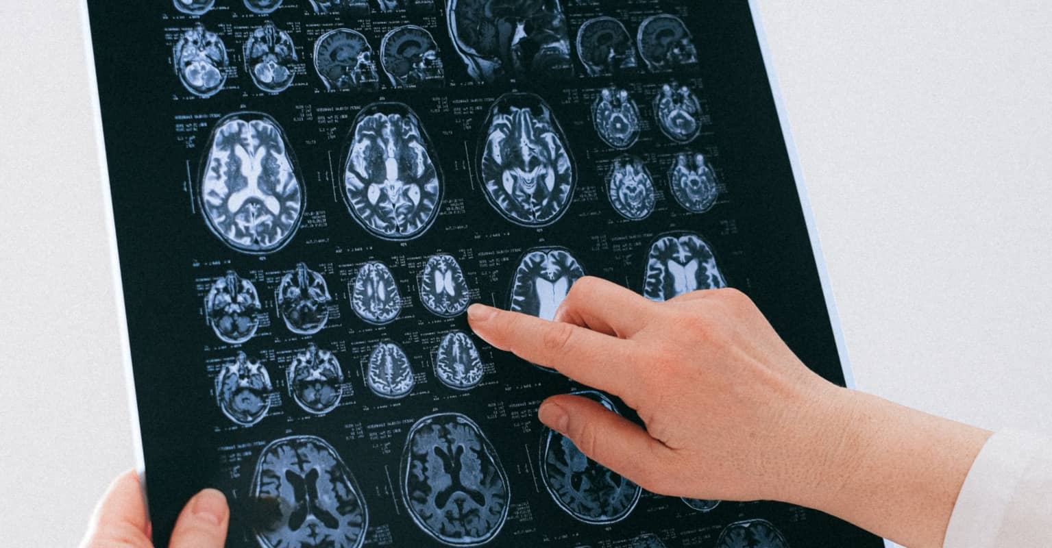 Doctor explains why we get deja vu and it's sending the Internet into meltdown