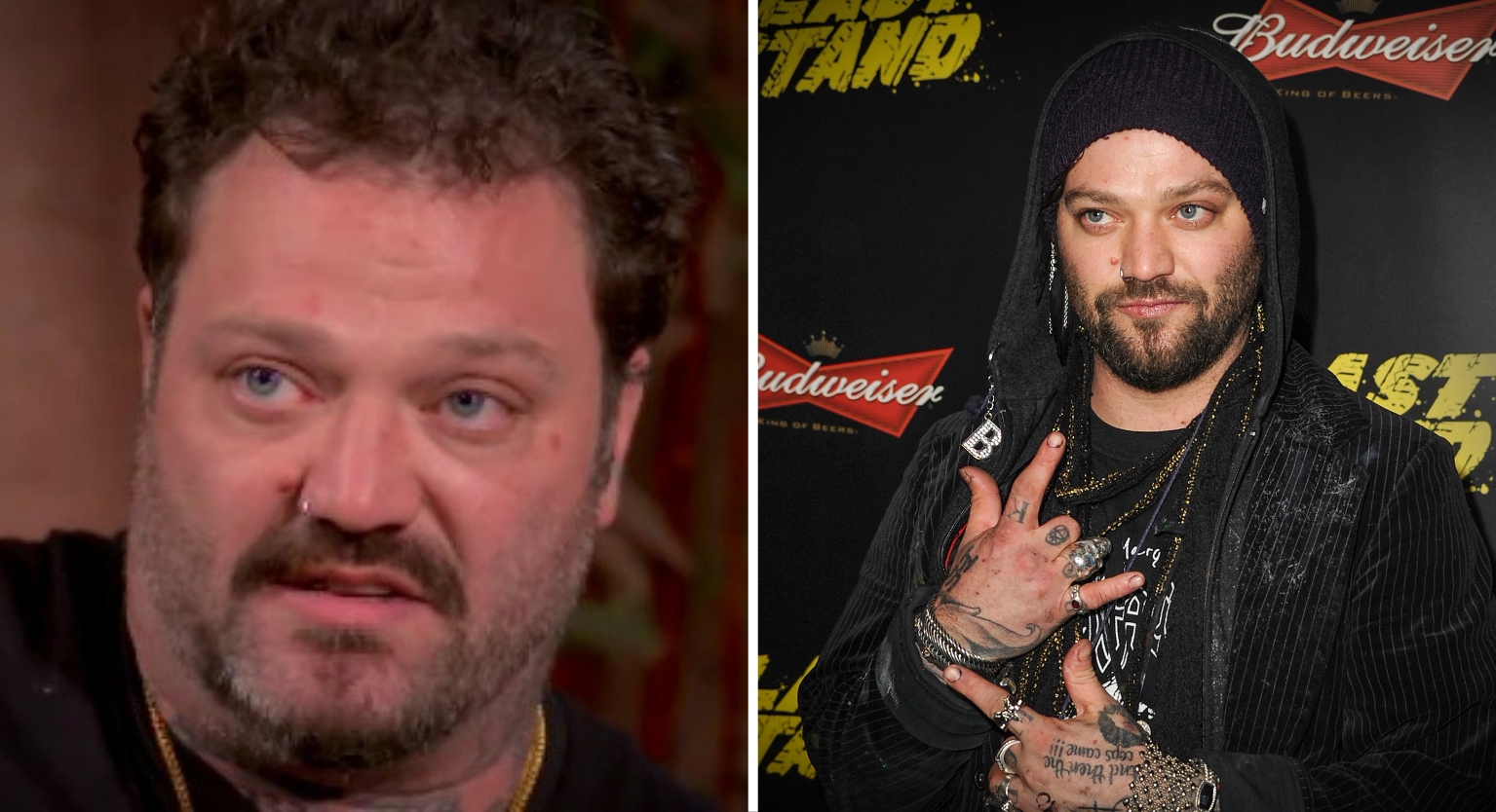 Bam Margera blames 'Jackass' for his addiction and drug use issues VT