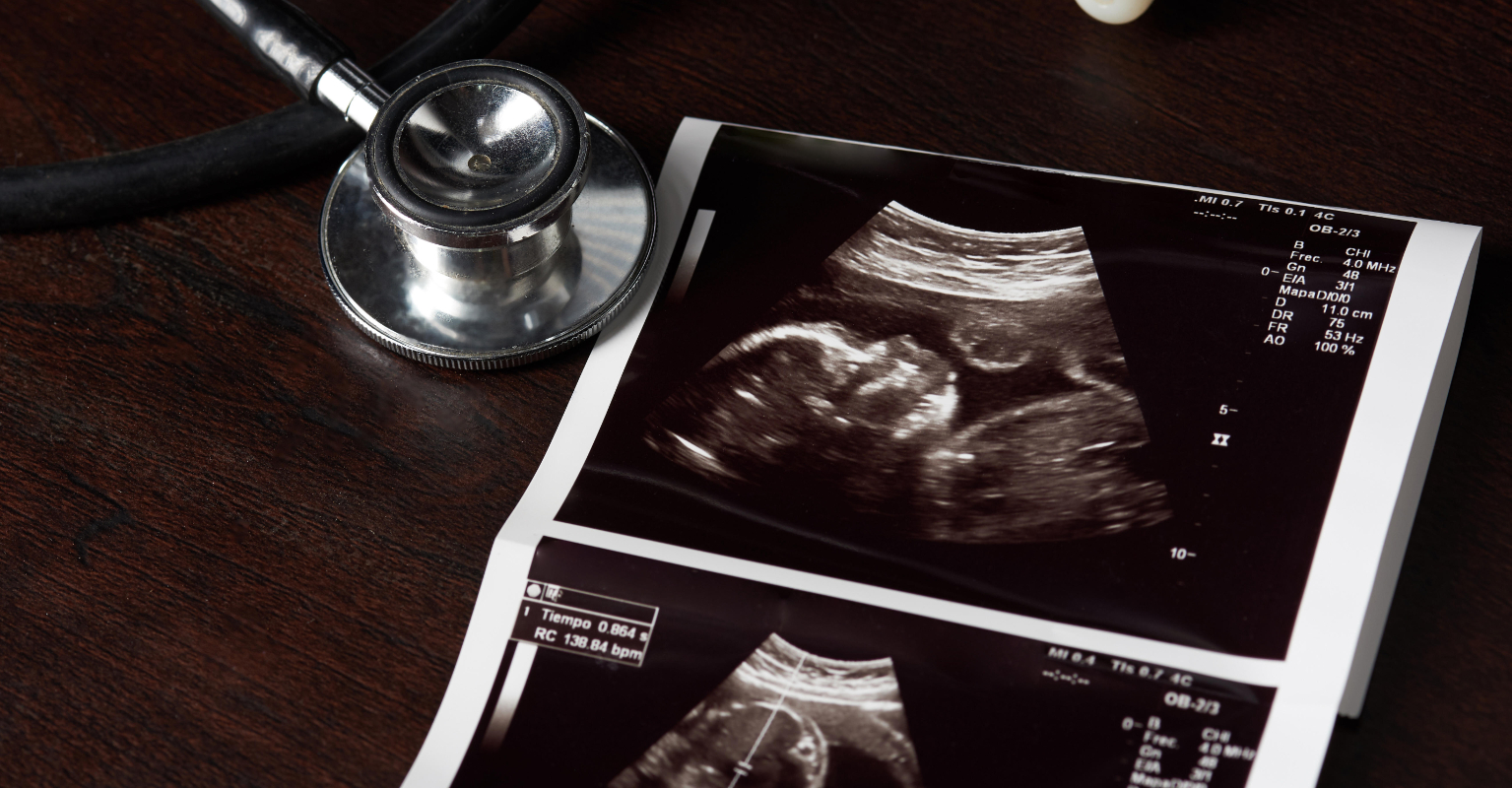 Mom who has already 'given birth' to her son will welcome him again in 11 weeks
