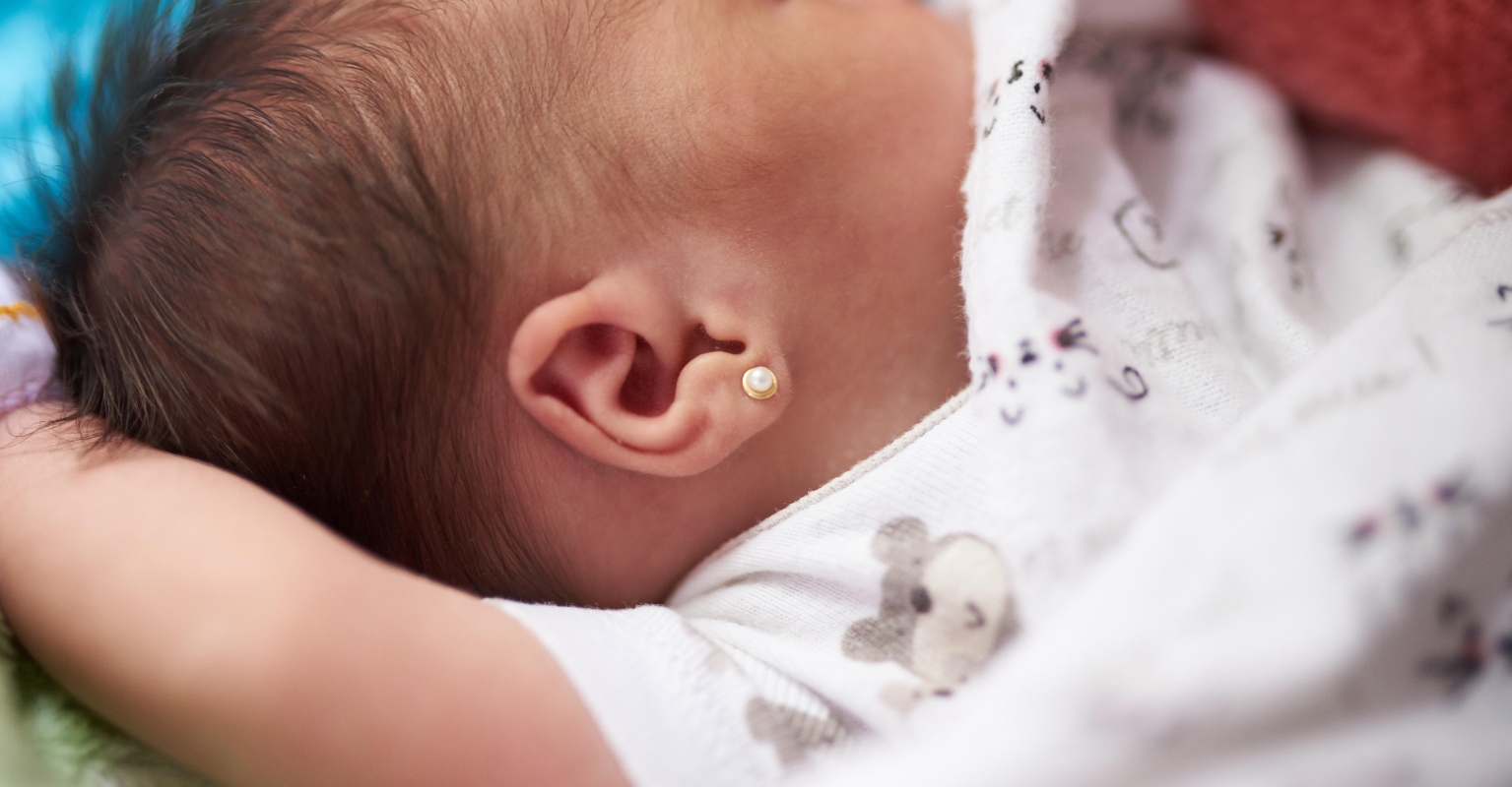 Mom is criticized by followers after removing baby's birthmark with laser treatment