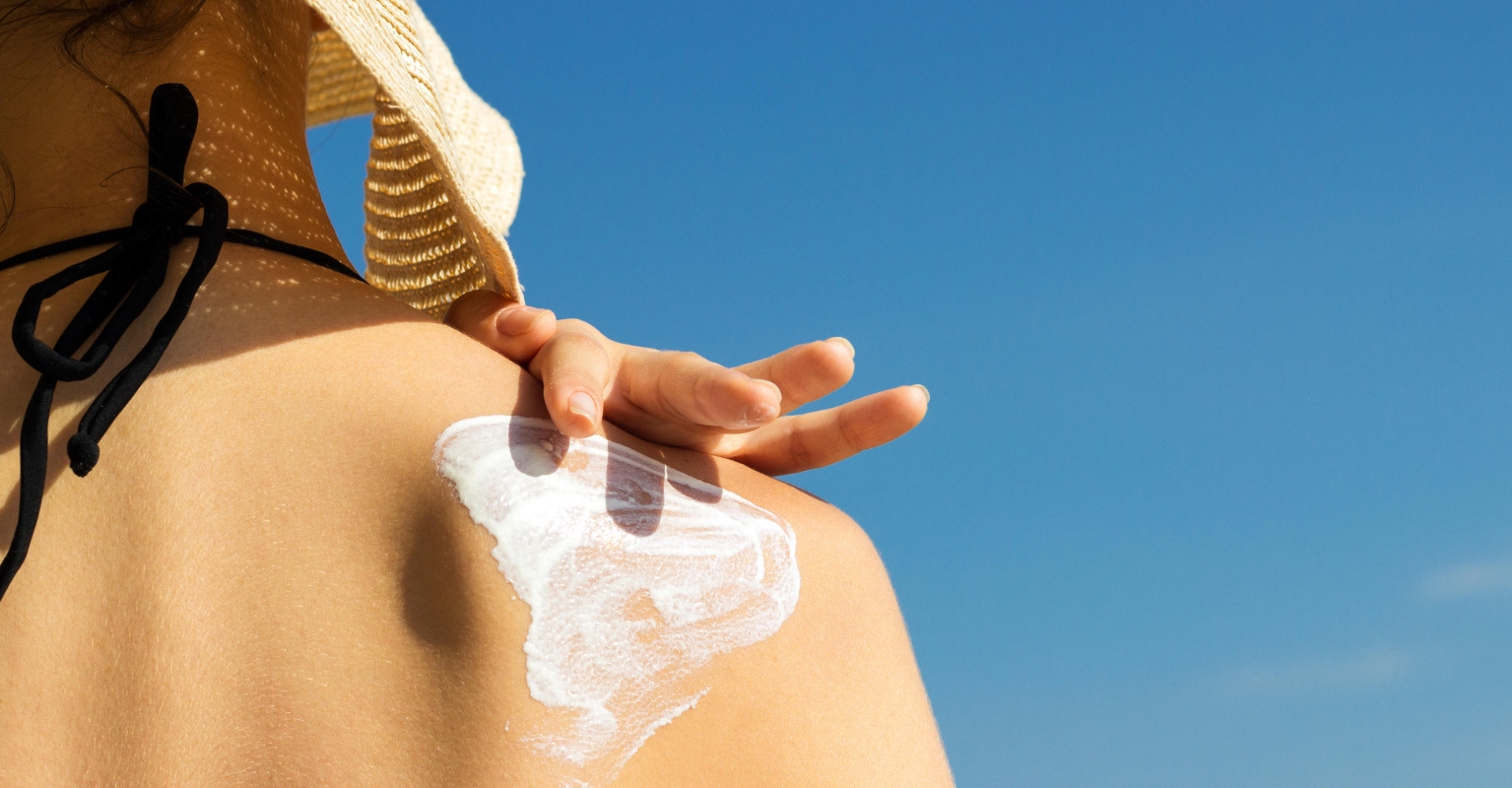 Woman shares second-degree burns to warn others not to use expired sunscreen