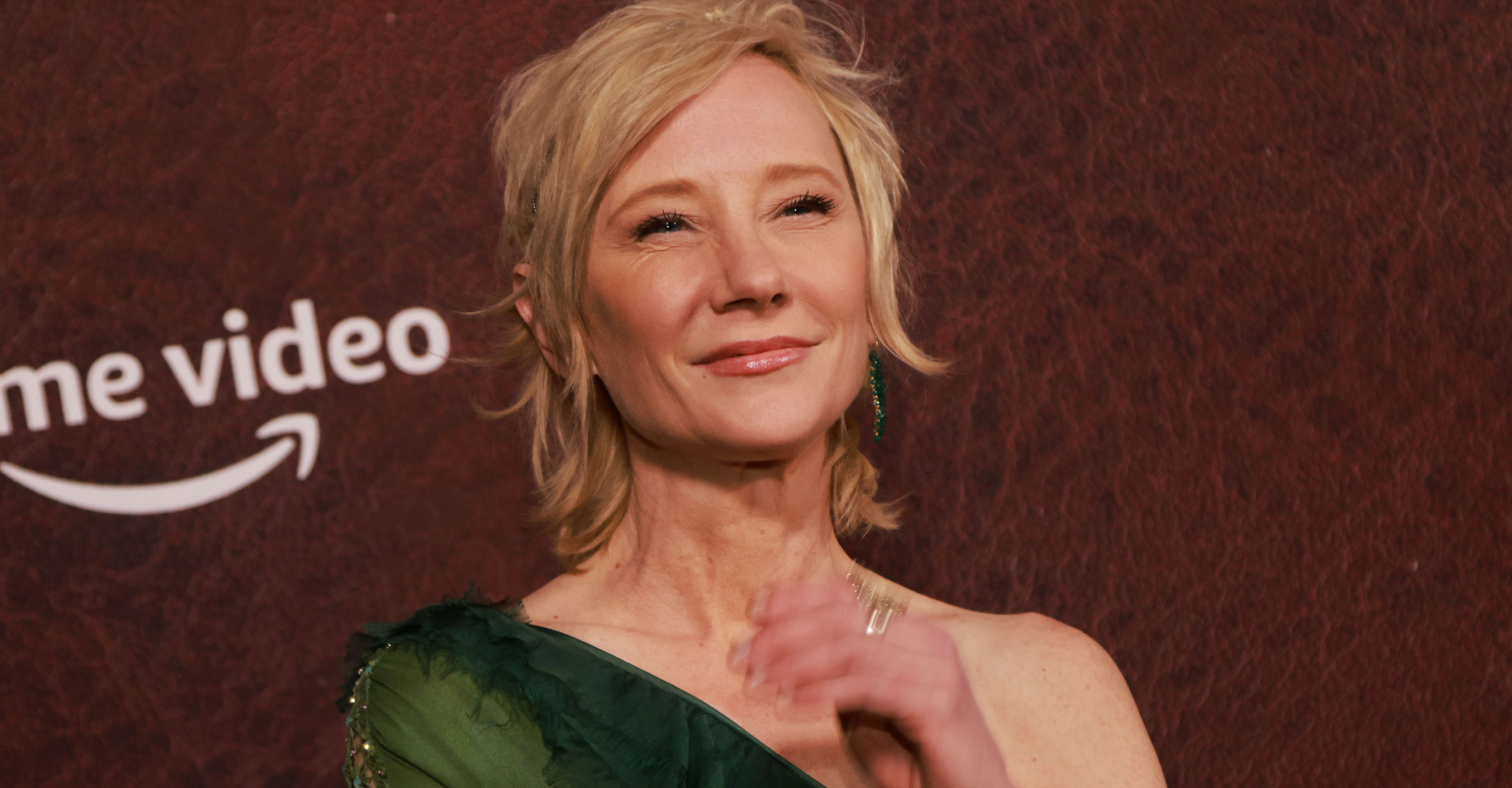 Anne Heche is under investigation for felony DUI after crashing her car into home