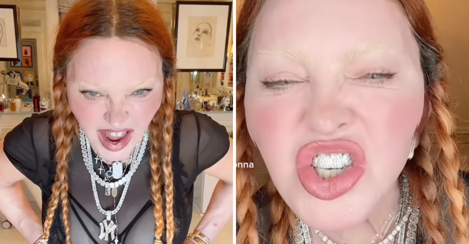 Madonna's fans voice concern for the singer after bizarre new video