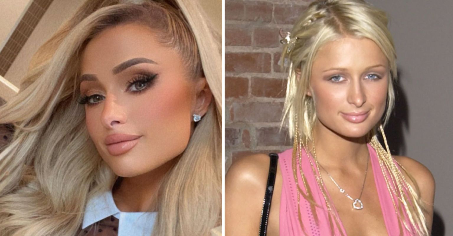 Paris Hilton Explains Why She Never Seems To Age