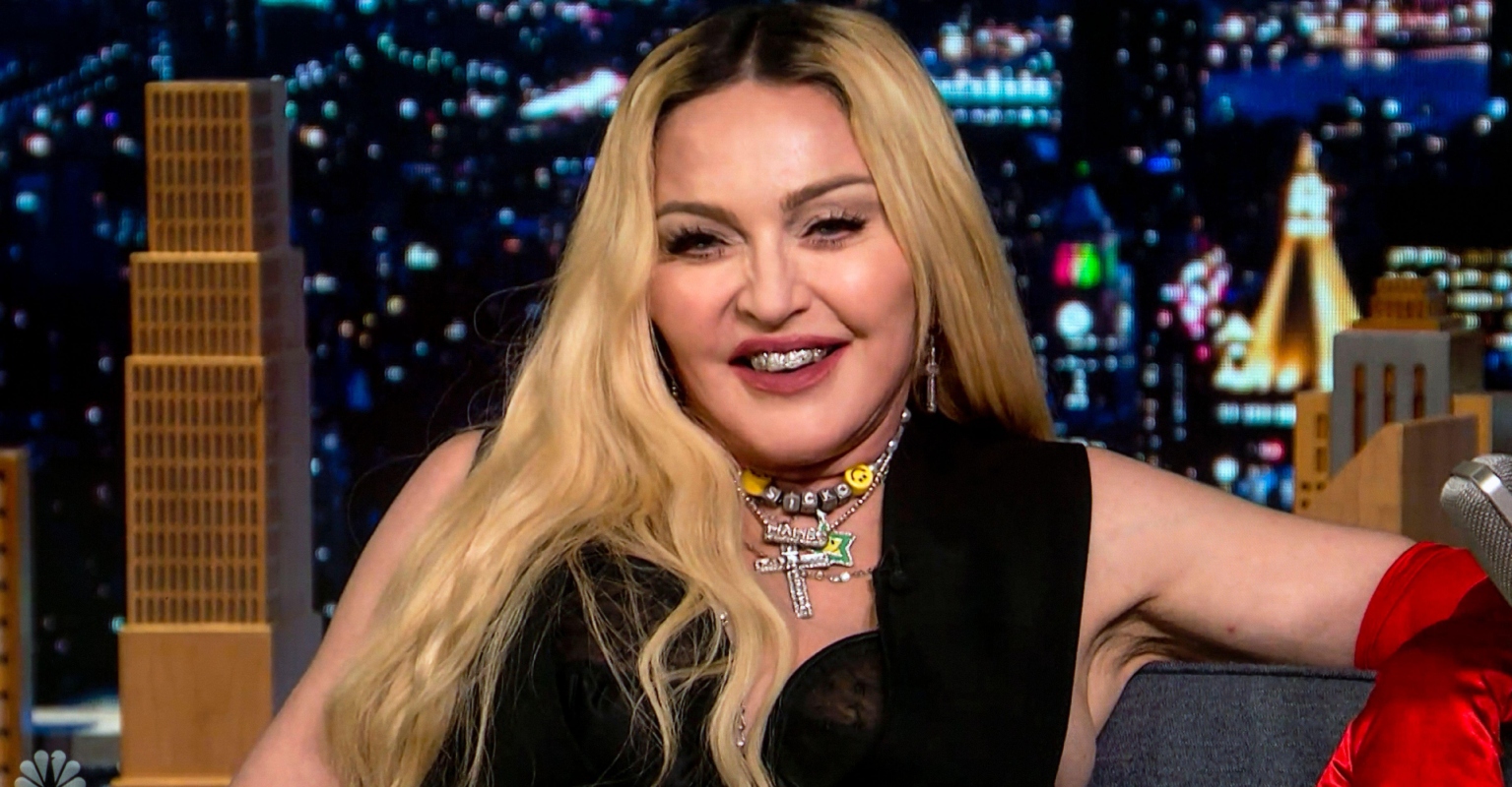 Madonna shares photo 'now swelling from surgery has gone down'
