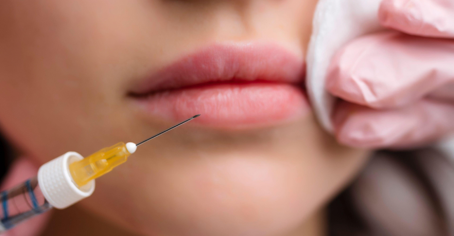 Woman issues warning after free lip fillers go horribly wrong