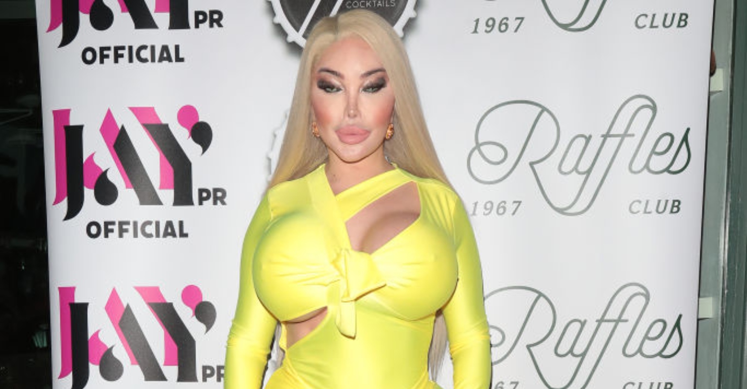 TV star Jessica Alves shows off results of $1 million surgeries