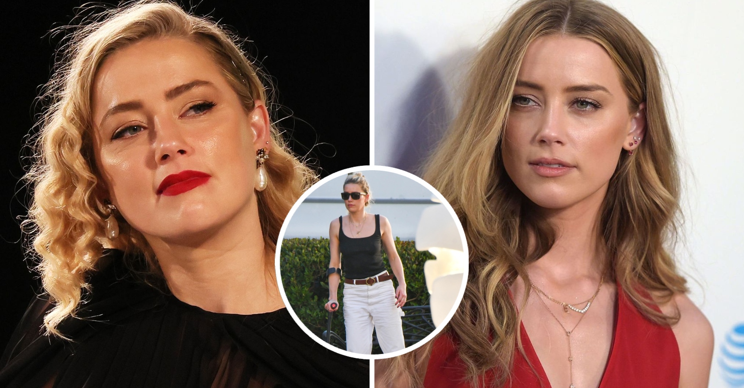 Amber Heard Spotted Walking With Crutch After Suffering Hip Injury
