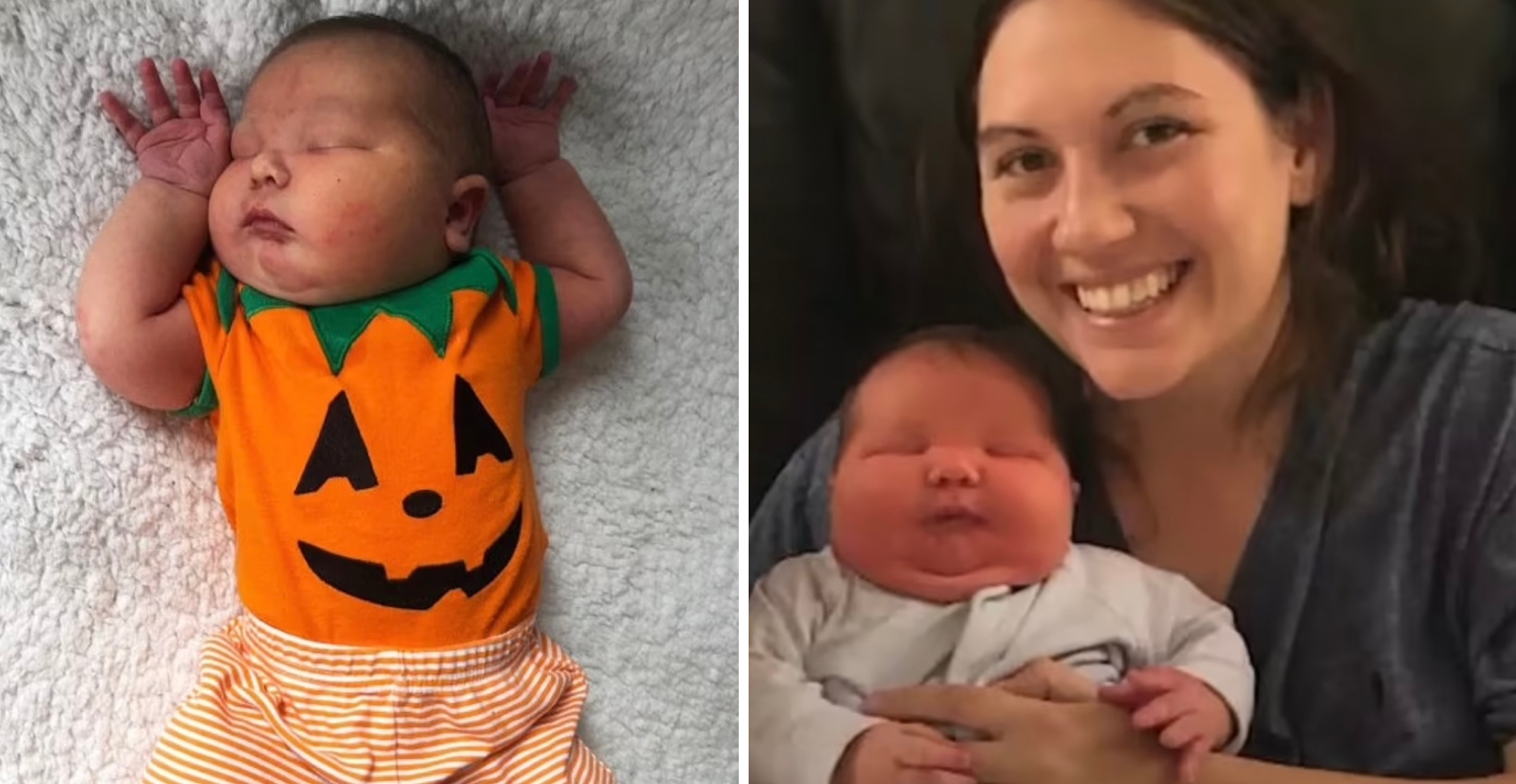 Parents Near15lb Baby Boy The Biggest On Record Since 2010