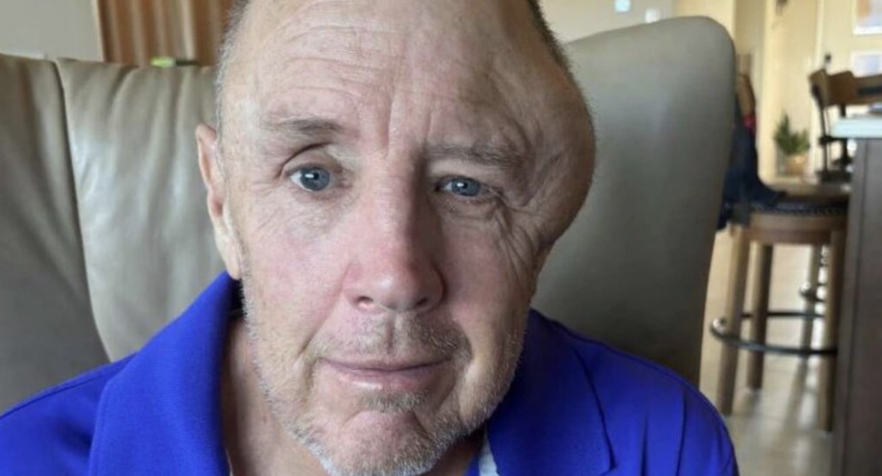 US man issued fine while fighting for his life in coma after being knocked down by e-bike