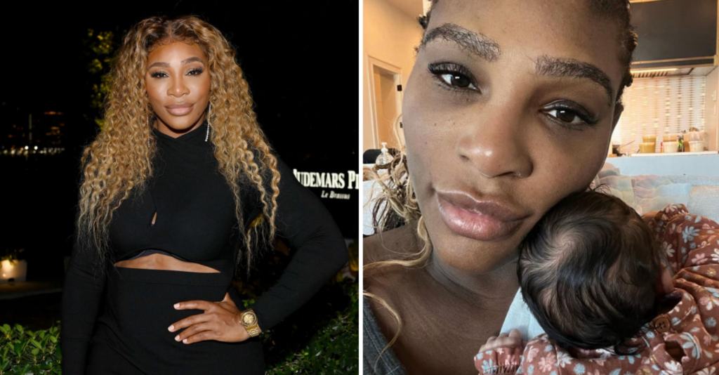 Serena Williams Praised For Sharing Her PostPartum Body 'Loving